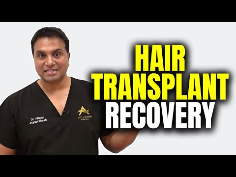 Hair Transplant Timeline How Long Do Hair Transplants Last?