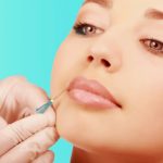Unlocking the Benefits of Botox Treatments